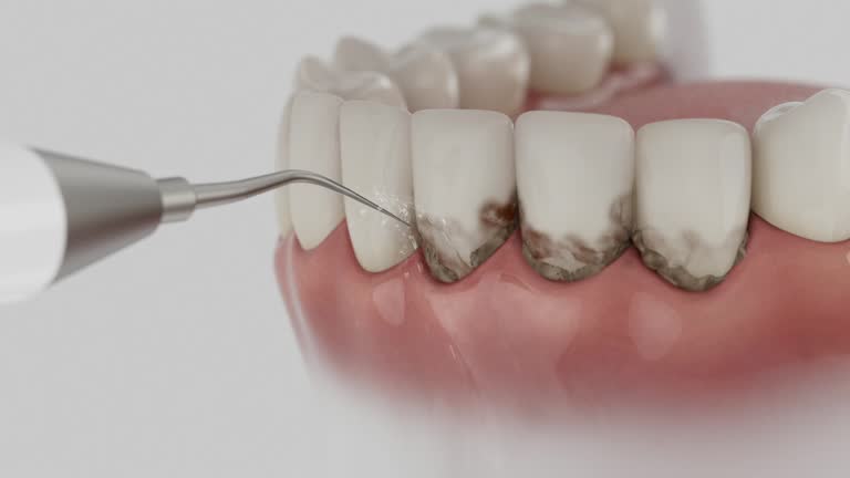 Trusted Teeth Cleaning And Checkup service in Kahaluu-Keauhou, HI - Dentist Open Now